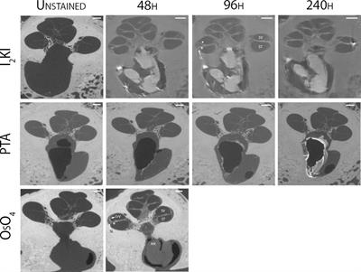 Reversible contrast enhancement for visualization of human temporal bones using micro computed tomography